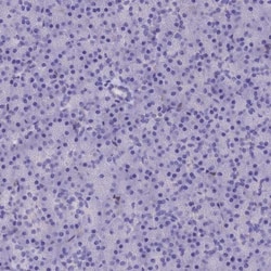 alcohol dehydrogenase 7 Antibody, Novus Biologicals:Antibodies:Primary