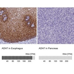 alcohol dehydrogenase 7 Antibody, Novus Biologicals:Antibodies:Primary