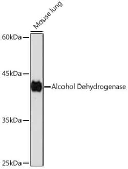 alcohol dehydrogenase Rabbit anti-Human, Mouse, Rat, Clone: 1X3C0, Novus Biologicals 100 &mu;g | Buy Online | Bio-Techne | Fisher Scientific