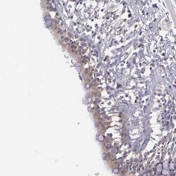 alpha 1-Microglobulin Antibody, Novus Biologicals 25 &mu;L; Unlabeled:Antibodies,