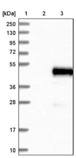 alpha 1-Microglobulin Antibody, Novus Biologicals 25 &mu;L; Unlabeled:Antibodies,