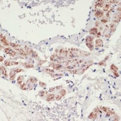 alpha-1A Adrenergic R/ADRA1A Rabbit anti-Human, Mouse, Rat, Polyclonal,