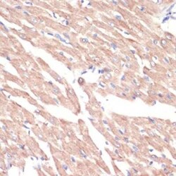 alpha-1A Adrenergic R/ADRA1A Rabbit anti-Human, Mouse, Rat, Polyclonal,