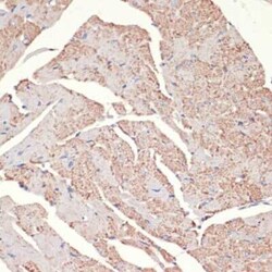 alpha-1A Adrenergic R/ADRA1A Rabbit anti-Human, Mouse, Rat, Polyclonal,