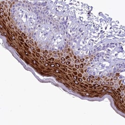 alpha 2-Macroglobulin-like 1/A2ML1 Antibody, Novus Biologicals:Antibodies:Primary