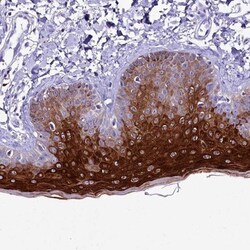 alpha 2-Macroglobulin-like 1/A2ML1 Antibody, Novus Biologicals 25 &mu;L | Buy Online | Novus Biologicals | Fisher Scientific