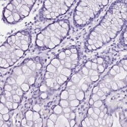 alpha 2-Macroglobulin-like 1/A2ML1 Antibody, Novus Biologicals 25 &mu;L | Buy Online | Novus Biologicals | Fisher Scientific