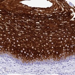 alpha 2-Macroglobulin-like 1/A2ML1 Antibody, Novus Biologicals 25 &mu;L | Buy Online | Novus Biologicals | Fisher Scientific