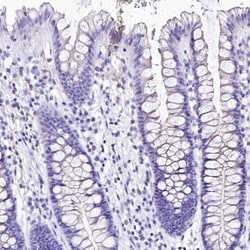 alpha 2-Macroglobulin-like 1/A2ML1 Antibody, Novus Biologicals:Antibodies:Primary