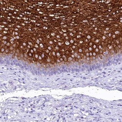 alpha 2-Macroglobulin-like 1/A2ML1 Antibody, Novus Biologicals:Antibodies:Primary