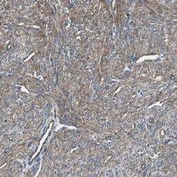 alpha-Actinin 1 Antibody, Novus Biologicals 0.1mL; Unlabeled:Antibodies,