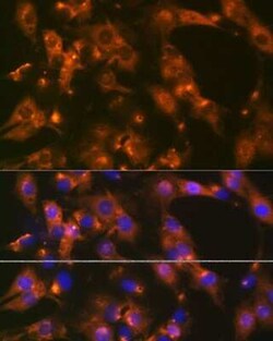 alpha Adaptin Rabbit anti-Human, Mouse, Rat, Clone: 8R8B6, Novus Biologicals
