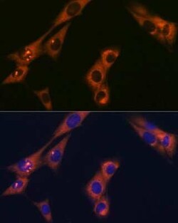alpha Adaptin Rabbit anti-Human, Mouse, Rat, Clone: 8R8B6, Novus Biologicals