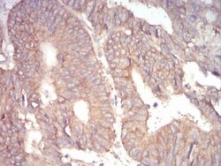 alpha Adducin Antibody (5D4H1) - BSA Free, Novus Biologicals:Antibodies:Primary