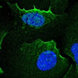 alpha Adducin Antibody, Novus Biologicals 25 &mu;L, Unlabeled:Antibodies,