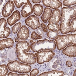alpha Adducin Antibody, Novus Biologicals 25 &mu;L, Unlabeled:Antibodies,
