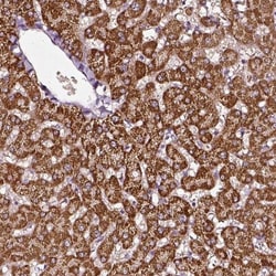 alpha-Aminoadipate Aminotransferase Antibody, Novus Biologicals:Antibodies:Primary