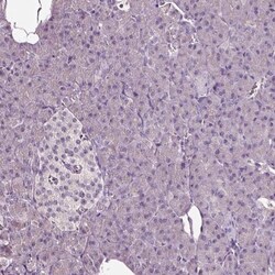 alpha-Aminoadipate Aminotransferase Antibody, Novus Biologicals:Antibodies:Primary
