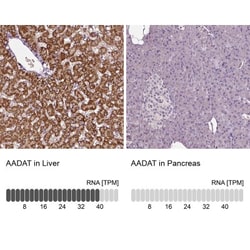 alpha-Aminoadipate Aminotransferase Antibody, Novus Biologicals:Antibodies:Primary