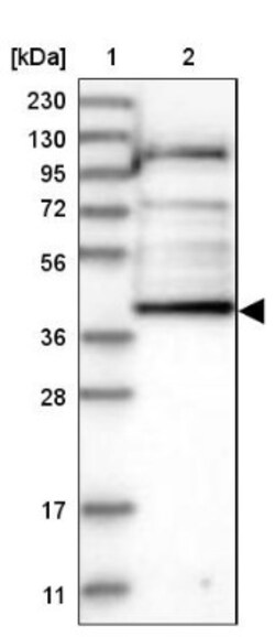alpha-Aminoadipate Aminotransferase Antibody, Novus Biologicals:Antibodies:Primary