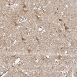 alpha COP I Antibody, Novus Biologicals 25 &mu;L; Unlabeled:Antibodies,