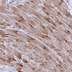 alpha Desmuslin Antibody, Novus Biologicals 25 &mu;L, Unlabeled:Antibodies,