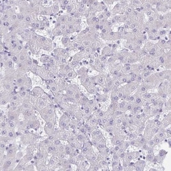 alpha Desmuslin Antibody, Novus Biologicals 25 &mu;L, Unlabeled:Antibodies,