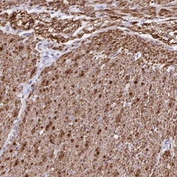 alpha Desmuslin Antibody, Novus Biologicals 25 &mu;L, Unlabeled:Antibodies,