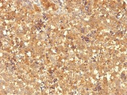 alpha-Fetoprotein/AFP Antibody (MBS-12), Novus Biologicals 0.2mg; Unlabeled:Antibodies,