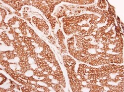 alpha Glucosidase 2 Antibody, Novus Biologicals 0.1mg; Unlabeled:Antibodies,