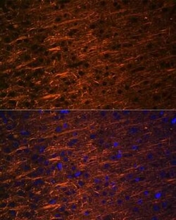 alpha-Internexin Rabbit anti-Human, Mouse, Rat, Clone: 5E5Z3, Novus Biologicals