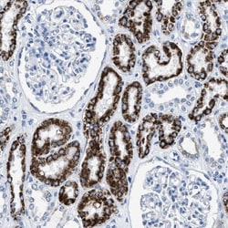 alpha-Methylacyl-CoA Racemase/AMACR Antibody, Novus Biologicals:Antibodies:Primary