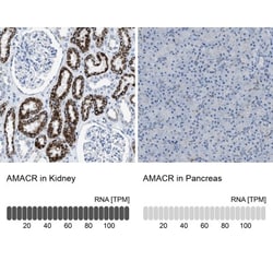 alpha-Methylacyl-CoA Racemase/AMACR Antibody, Novus Biologicals:Antibodies:Primary
