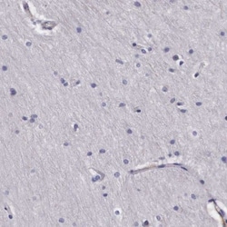alpha-N-acetylgalactosaminidase/NAGA Antibody, Novus Biologicals 0.1mL;