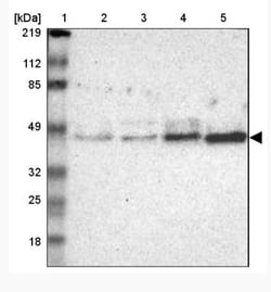 alpha-N-acetylgalactosaminidase/NAGA Antibody, Novus Biologicals 0.1mL;
