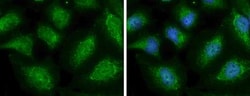 alpha-N-acetylglucosaminidase/NAGLU Antibody, Novus Biologicals 0.1mg;