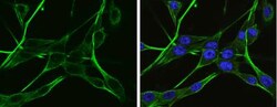 alpha-N-acetylglucosaminidase/NAGLU Antibody, Novus Biologicals 0.1mg;