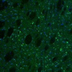alpha-N-acetylglucosaminidase/NAGLU Antibody, Novus Biologicals 25 &mu;L;