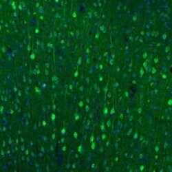 alpha-N-acetylglucosaminidase/NAGLU Antibody, Novus Biologicals 25 &mu;L;