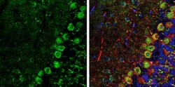 alpha-N-acetylglucosaminidase/NAGLU Antibody, Novus Biologicals 0.1mg;