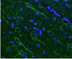 alpha-N-acetylglucosaminidase/NAGLU Antibody, Novus Biologicals 0.1mg;