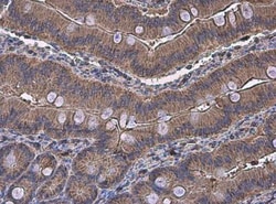 alpha-N-acetylglucosaminidase/NAGLU Antibody, Novus Biologicals 0.1mg;