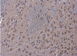 alpha-N-acetylglucosaminidase/NAGLU Antibody, Novus Biologicals 0.1mg;