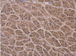 alpha-N-acetylglucosaminidase/NAGLU Antibody, Novus Biologicals 0.1mg;