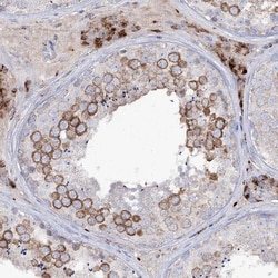 alpha-N-acetylglucosaminidase/NAGLU Antibody, Novus Biologicals 25 &mu;L;