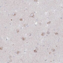 alpha-N-acetylglucosaminidase/NAGLU Antibody, Novus Biologicals 25 &mu;L;