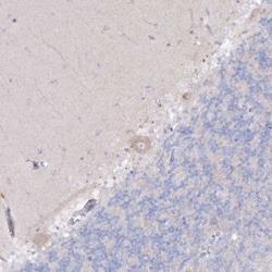 alpha-N-acetylglucosaminidase/NAGLU Antibody, Novus Biologicals 25 &mu;L;