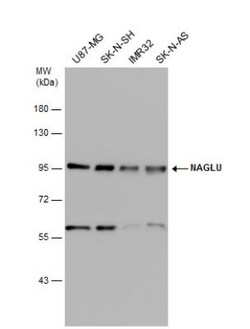 alpha-N-acetylglucosaminidase/NAGLU Antibody, Novus Biologicals 0.1mL;