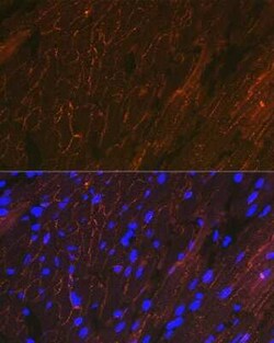 alpha-Sarcoglycan Rabbit anti-Human, Mouse, Rat, Clone: 3W3Q10, Novus Biologicals:Antibodies:Primary