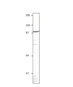 alpha-Sarcoglycan Antibody, Novus Biologicals 100 &mu;g | Buy Online | Novus Biologicals | Fisher Scientific